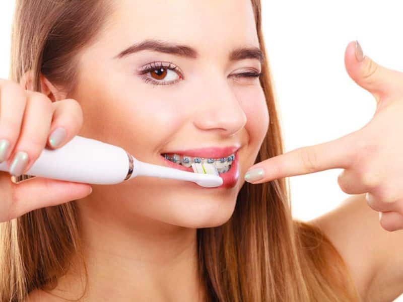 Người niềng răng được nha sĩ khuyến nghị dùng bàn chải điện