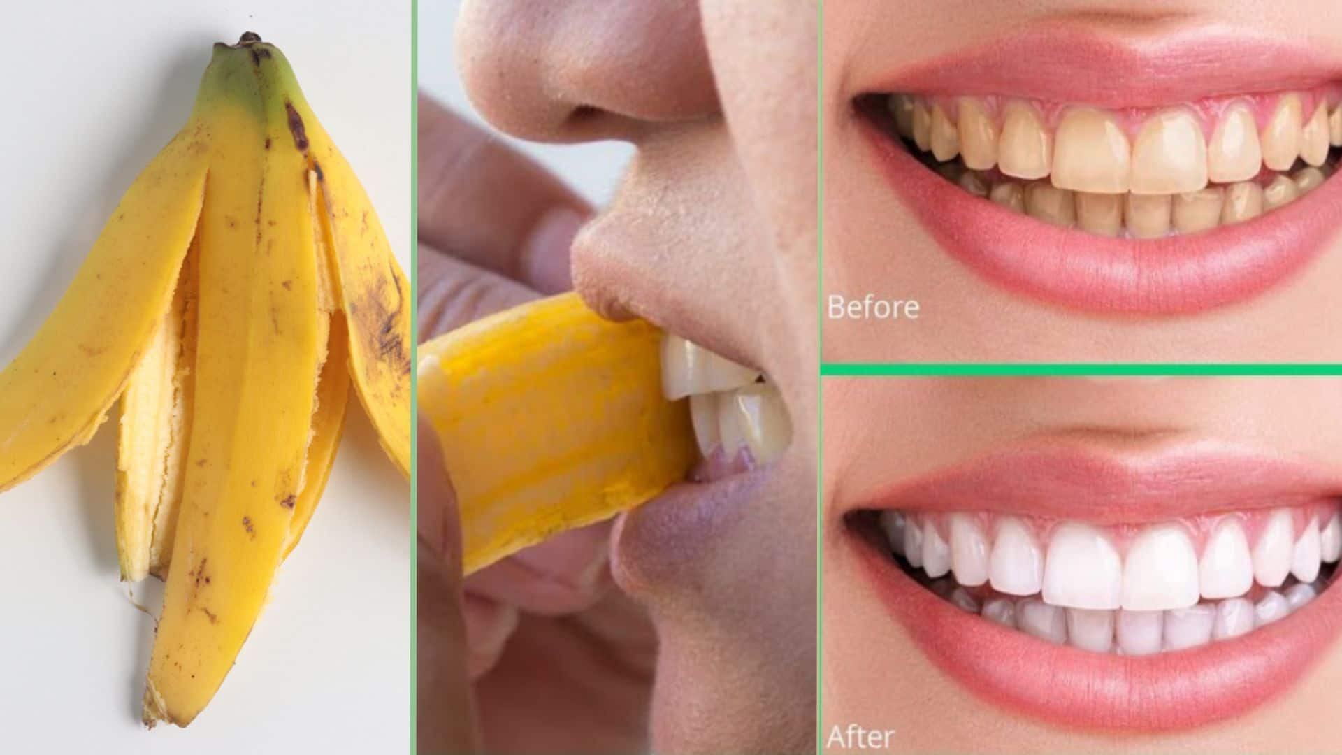 Làm trắng răng bằng vỏ chuối có hiệu quả không - colgate