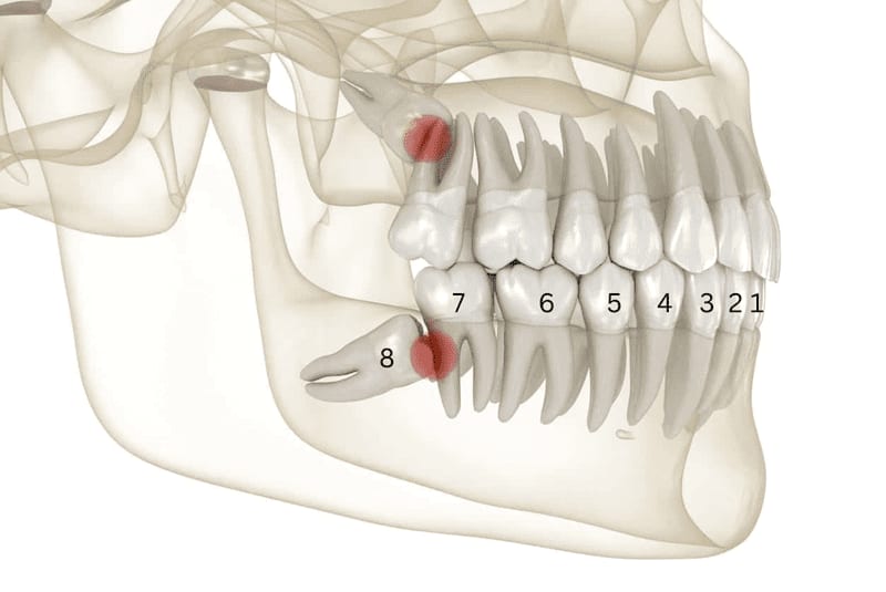 Răng khôn là răng mọc trong cùng của hàm răng